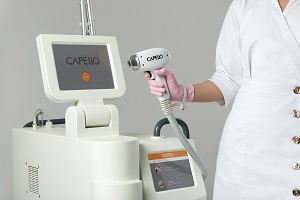 Технология Capello Eventum - прорыв в области лазерной эпиляции!