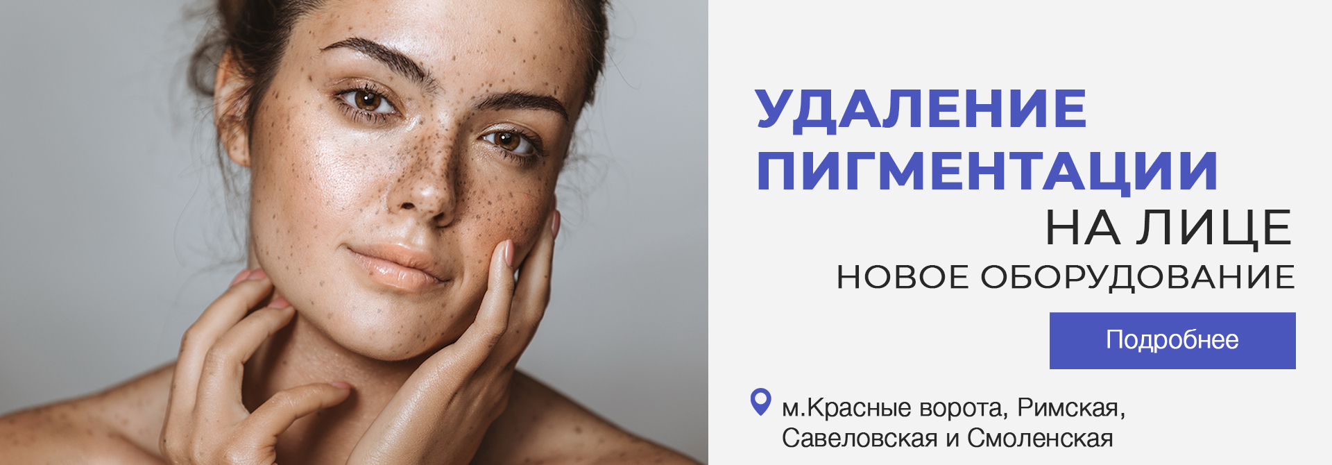  Удаление пигментации 